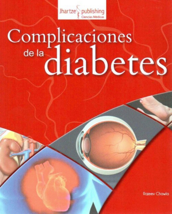 Chawla. Complicaciones de la diabetes Chawla. Complicaciones de la diabetes