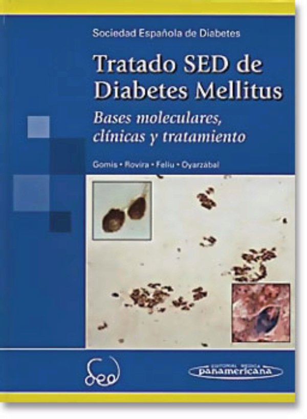 La diabetes es una enfermedad cronica que afecta casi un La diabetes es una enfermedad cronica que afecta casi un
