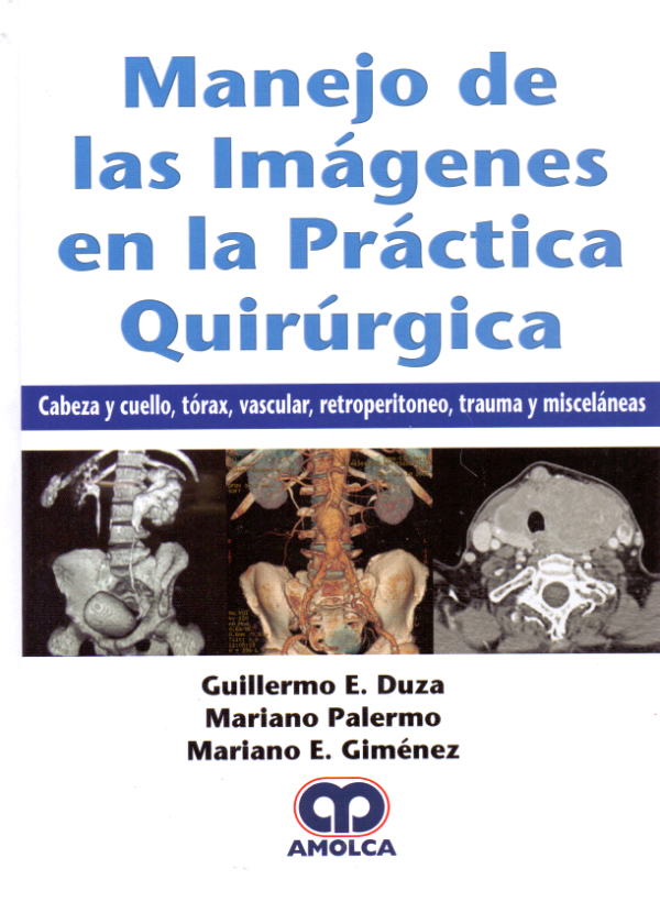 Trauma De Torax Ebook