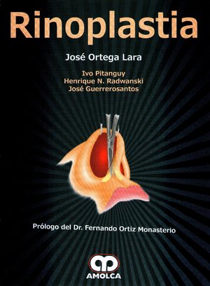 Manual De Oncologia Procedimientos Medico Quirurgicos Ebook