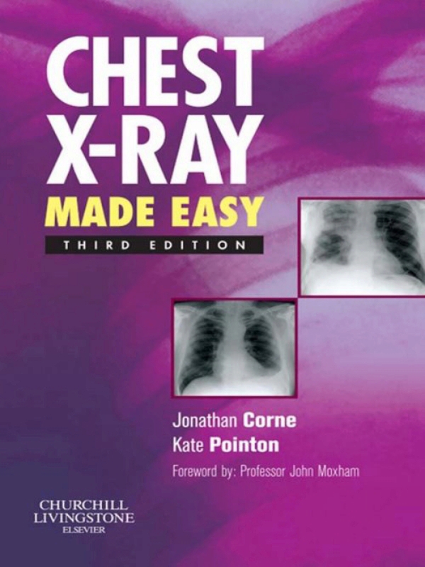 Chest XRay Made Easy (ebook)