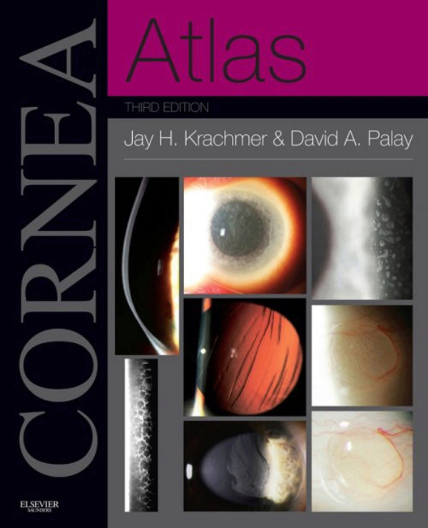 download color atlas of melanocytic lesions