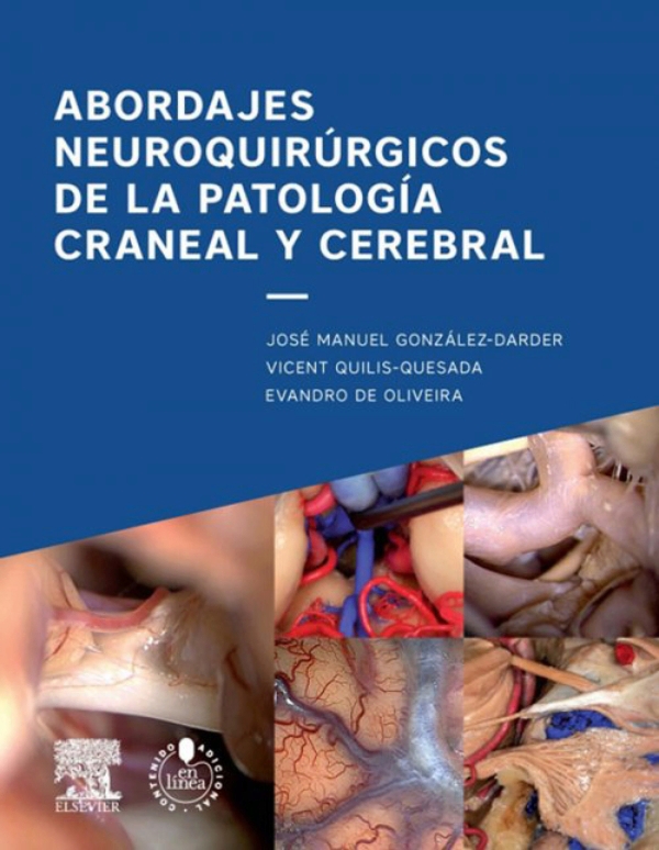 Abordajes Neuroquirurgicos de la Patología Craneal y Cerebral, Elsevier 2016  31018_9788490229682