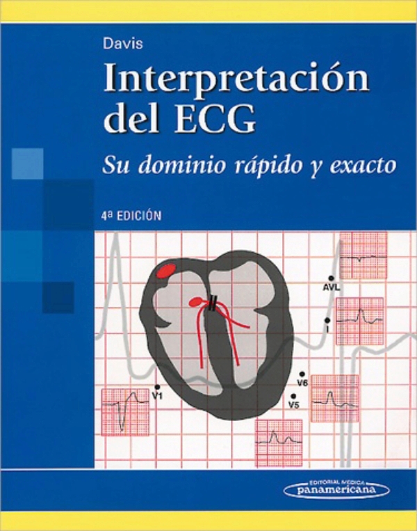 INTERPRETACION DEL ECG DUBIN PDF