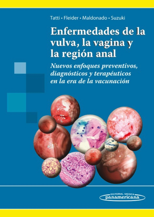 Tatti. Enfermedades de la vulva, la vagina y la región anal. Tatti. Enfermedades de la vulva, la vagina y la región anal.