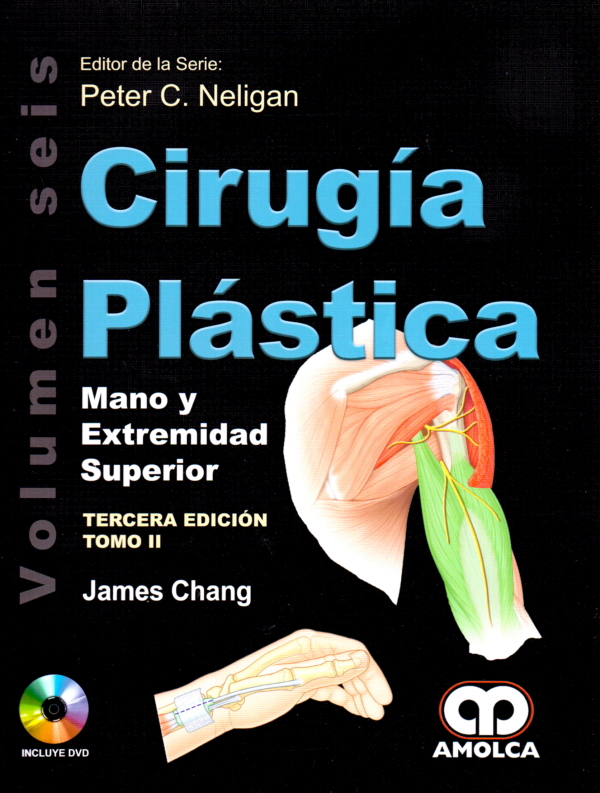 Cirugía Plástica. Mano y Extremidad Superior 2 Tomos
